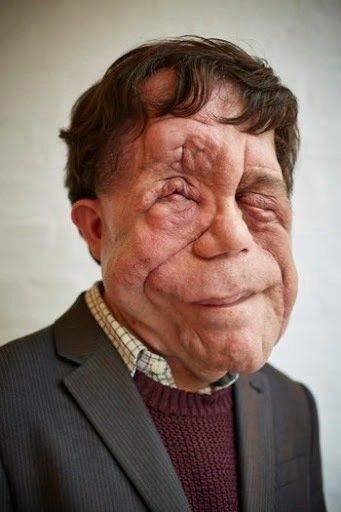 Adam Pearson Image