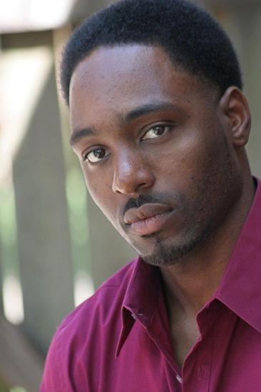 Reginal Varice Image