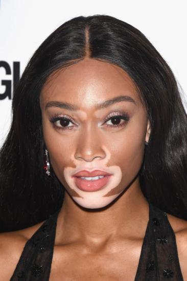 Winnie Harlow Image